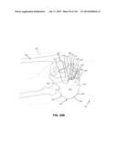 SYSTEMS AND METHODS FOR FUSING A SACROILIAC JOINT AND ANCHORING AN     ORTHOPEDIC APPLIANCE diagram and image