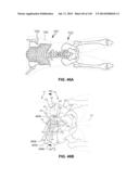 SYSTEMS AND METHODS FOR FUSING A SACROILIAC JOINT AND ANCHORING AN     ORTHOPEDIC APPLIANCE diagram and image