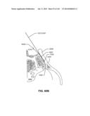 SYSTEMS AND METHODS FOR FUSING A SACROILIAC JOINT AND ANCHORING AN     ORTHOPEDIC APPLIANCE diagram and image