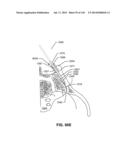 SYSTEMS AND METHODS FOR FUSING A SACROILIAC JOINT AND ANCHORING AN     ORTHOPEDIC APPLIANCE diagram and image