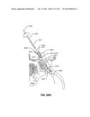 SYSTEMS AND METHODS FOR FUSING A SACROILIAC JOINT AND ANCHORING AN     ORTHOPEDIC APPLIANCE diagram and image