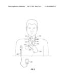 Combination Device and Methods for Treating Congestive Heart Failure and     Stroke diagram and image