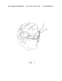 Field of View Matching in a Visual Prosthesis diagram and image