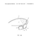 Field of View Matching in a Visual Prosthesis diagram and image