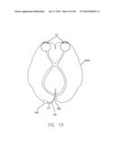 Field of View Matching in a Visual Prosthesis diagram and image