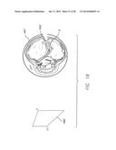 Field of View Matching in a Visual Prosthesis diagram and image