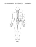 MRI-Safe Implantable Lead diagram and image