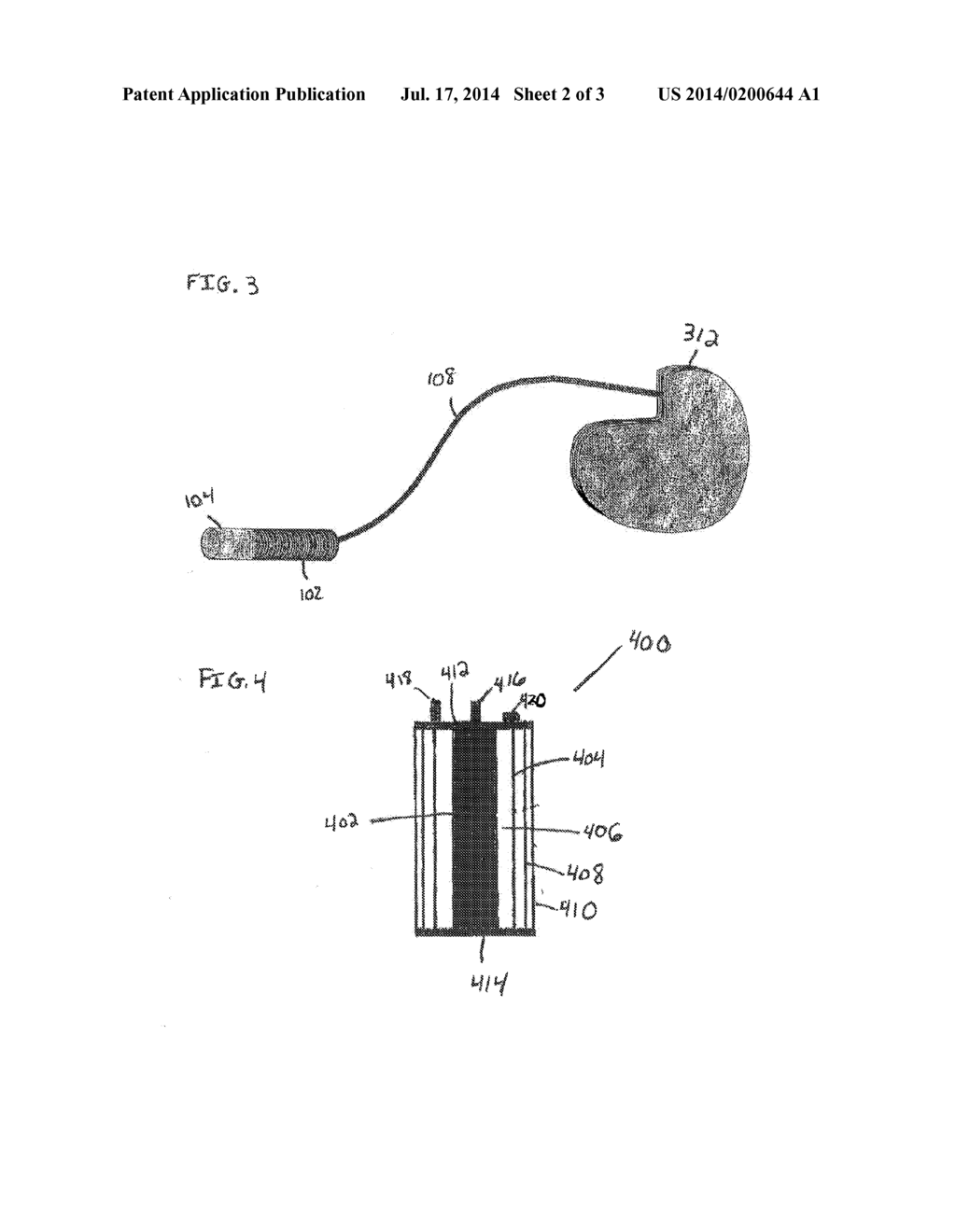 BIOELECTRIC BATTERY FOR IMPLANTABLE DEVICE APPLICATIONS - diagram, schematic, and image 03