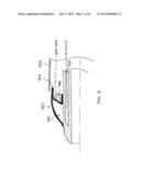 Systems, Methods and Devices for Retrograde Pericardial Release of a     Prosthetic Heart Valve diagram and image