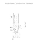 Systems, Methods and Devices for Retrograde Pericardial Release of a     Prosthetic Heart Valve diagram and image