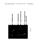 Systems, Methods and Devices for Retrograde Pericardial Release of a     Prosthetic Heart Valve diagram and image