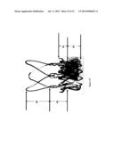 Systems, Methods and Devices for Retrograde Pericardial Release of a     Prosthetic Heart Valve diagram and image