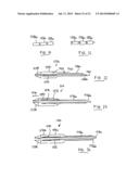 Systems, Methods and Devices for Retrograde Pericardial Release of a     Prosthetic Heart Valve diagram and image