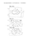 IMPLANT SYSTEM HAVING A MULTIFUNCTIONAL INSERTER AND COMPLEMENTARY IMPLANT diagram and image