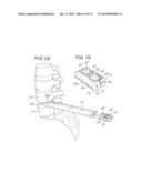 IMPLANT SYSTEM HAVING A MULTIFUNCTIONAL INSERTER AND COMPLEMENTARY IMPLANT diagram and image