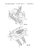 RETAINING MECHANISM, IMPLANT, AND TOOL diagram and image