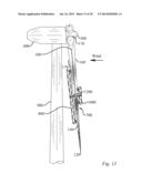 METHOD OF REPAIRING A WIND TURBINE BLADE diagram and image