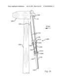 METHOD OF REPAIRING A WIND TURBINE BLADE diagram and image