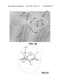 MEDICAL TUBES AND METHODS OF MANUFACTURE diagram and image