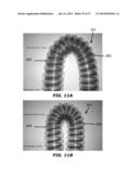 MEDICAL TUBES AND METHODS OF MANUFACTURE diagram and image