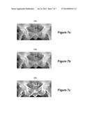 METHOD FOR INTERACTIVE MANUAL MATCHING AND REAL-TIME PROJECTION     CALCULATION IN IMAGING diagram and image