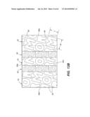 Self Ligating Orthodontic Bracket Having a Rotatable Member diagram and image