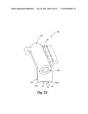 Self Ligating Orthodontic Bracket Having a Rotatable Member diagram and image