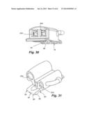 Self Ligating Orthodontic Bracket Having a Rotatable Member diagram and image