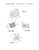 Self Ligating Orthodontic Bracket Having a Rotatable Member diagram and image