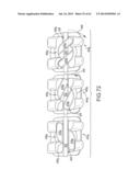 Self Ligating Orthodontic Bracket Having a Rotatable Member diagram and image