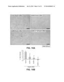 Method for Identifying Agents that Inhibit Cell Migration, Promote Cell     Adhesion and Prevent Metastasis diagram and image