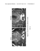 METHODS AND COMPOSITIONS FOR INHIBITING CELLULAR PROLIFERATION AND     SURGICAL ADHESION diagram and image