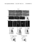 PHENYLBUTYRATE FOR TREATMENT OF SPORADIC INCLUSION-BODY MYOSITIS AND     DISORDERS RELATING TO AUTOPHAGY IMPAIRMENT OR AMYLOID BETA 42     ACCUMULATION diagram and image