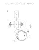 METHOD OF TISSUE SEPARATION USING FLUIDIC PULSES TO MINIMIZE TISSUE TRAUMA     DURING CATHETER INSERTION diagram and image