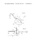 DEVICES, SYSTEMS, AND METHODS FOR EPICARDIAL CARDIAC MONITORING diagram and image