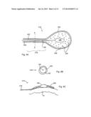 DEVICES, SYSTEMS, AND METHODS FOR EPICARDIAL CARDIAC MONITORING diagram and image