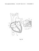 Medical apparatus for fluid communication diagram and image