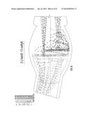 PULSED NEBULIZER diagram and image