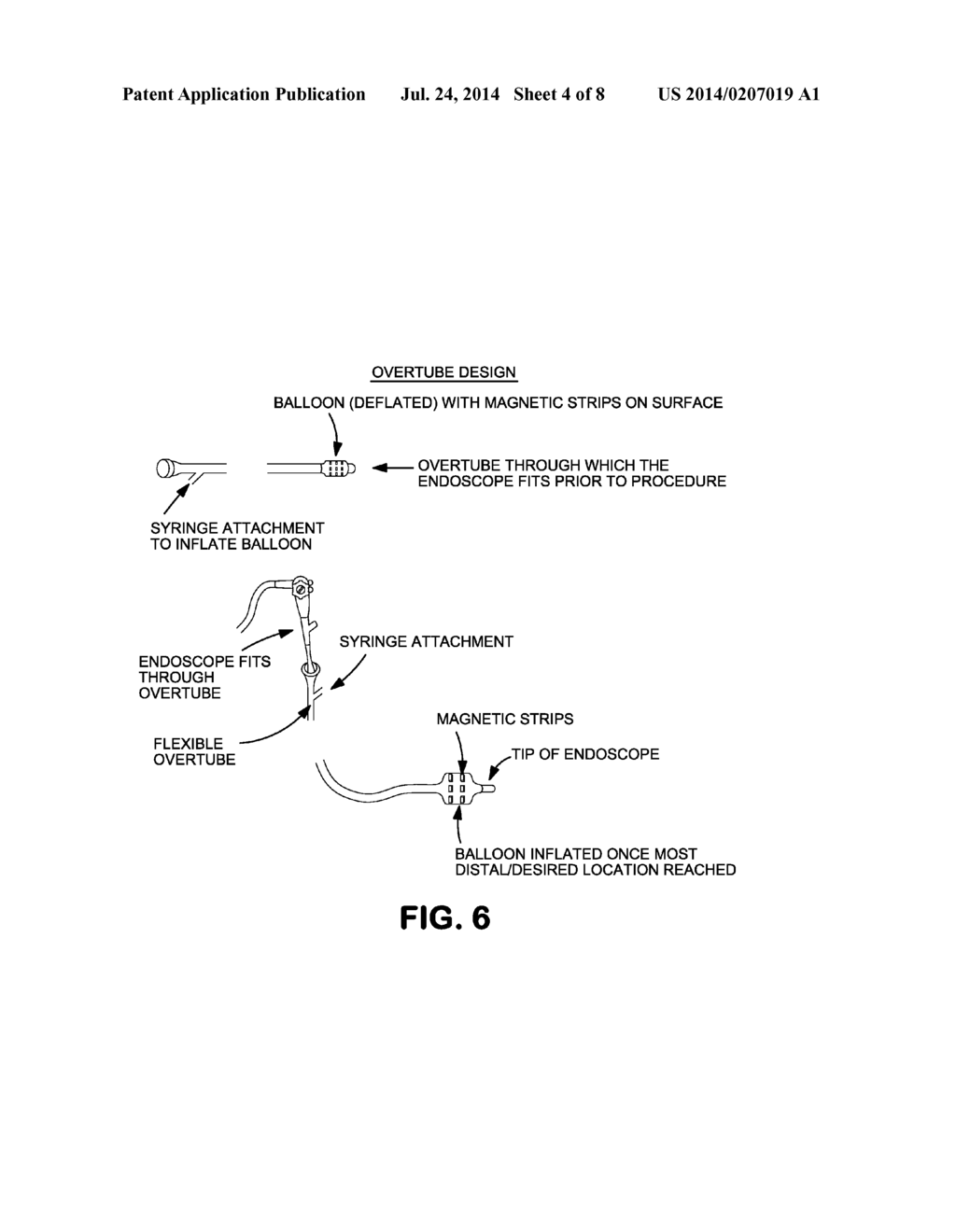 Method and Device for Statistical Tissue Sampling Using Microdevices - diagram, schematic, and image 05