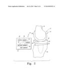 SYSTEM AND METHOD FOR DETERMINING PATIENT FOLLOW-UP SUBSEQUENT TO AN     ORTHOPAEDIC PROCEDURE diagram and image