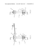 Non-Balloon Low Profile Feed Device With Insertion/Removal Tool diagram and image