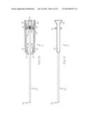 Non-Balloon Low Profile Feed Device With Insertion/Removal Tool diagram and image