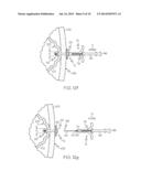 Non-Balloon Low Profile Feed Device With Insertion/Removal Tool diagram and image