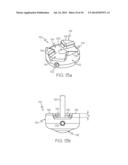 Non-Balloon Low Profile Feed Device With Insertion/Removal Tool diagram and image