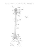 Knockout Tool for Minimally Invasive Prosthesis Revision diagram and image