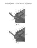 ADJUSTABLE ALLOGRAFT TEMPLATES AND METHODS OF USE diagram and image