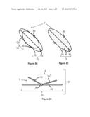 ANEURYSM CLOSURE CLIP diagram and image