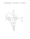 ULTRASONIC DEVICE FOR CUTTING AND COAGULATING diagram and image