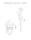 MEDICAL DEVICE FOR MODIFICATION OF LEFT ATRIAL APPENDAGE AND RELATED     SYSTEMS AND METHODS diagram and image