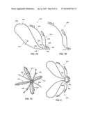 MEDICAL DEVICE FOR MODIFICATION OF LEFT ATRIAL APPENDAGE AND RELATED     SYSTEMS AND METHODS diagram and image